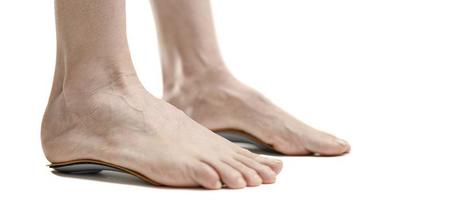 Arch Support Aids in Preventing Common Foot-Related Problems